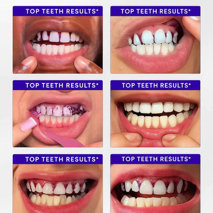 Purple Teeth Whitening Strips