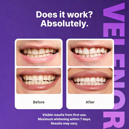 Purple Teeth Whitening Strips