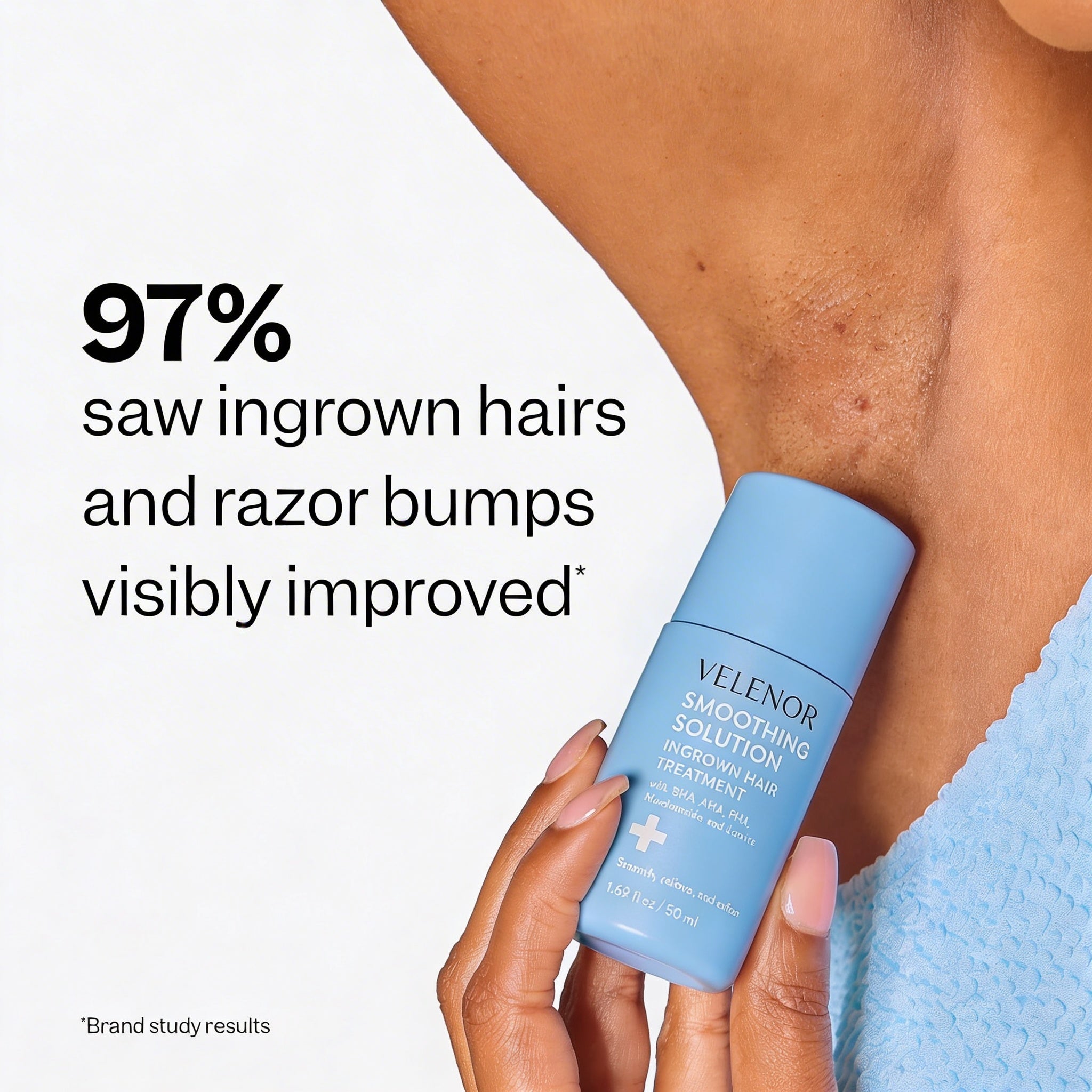SmoothRoll Ingrown Hair Solution