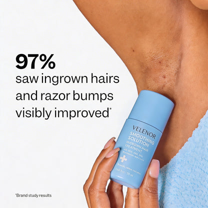 SmoothRoll Ingrown Hair Solution